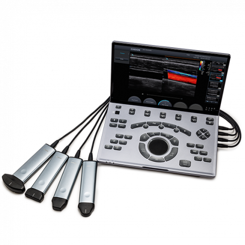 Портативный УЗИ Chison Sonoair 70